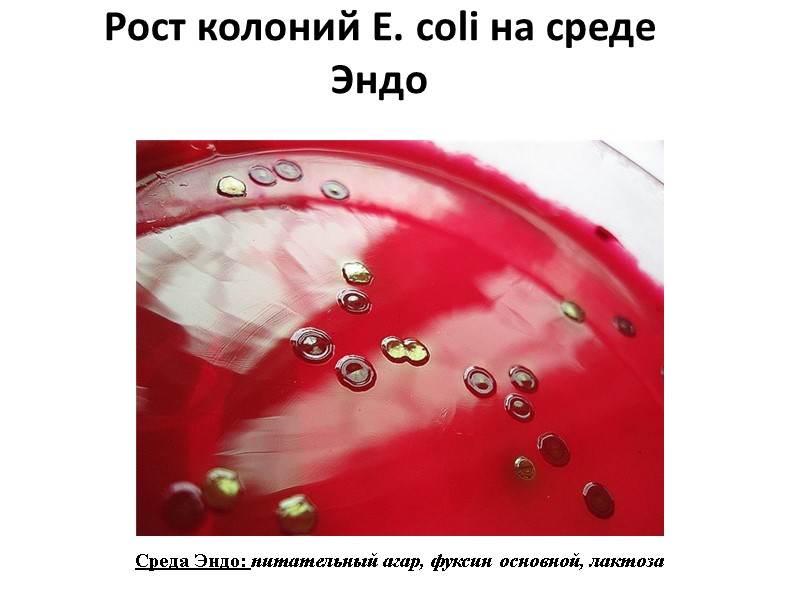 Рост колоний E. coli на среде Эндо Среда Эндо: питательный агар, фуксин основной, лактоза